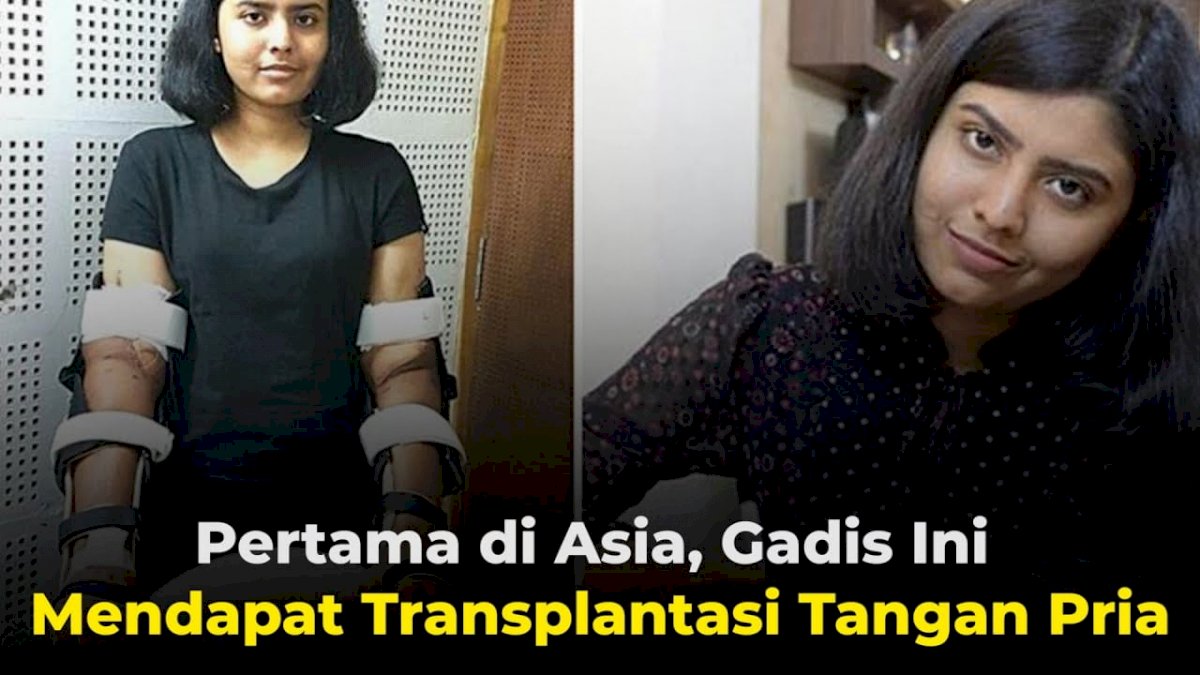 VIDEO: Pertama di Asia, Gadis Ini Mendapat Transplantasi Tangan Pria