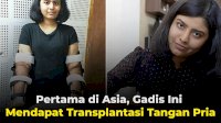 VIDEO: Pertama di Asia, Gadis Ini Mendapat Transplantasi Tangan Pria