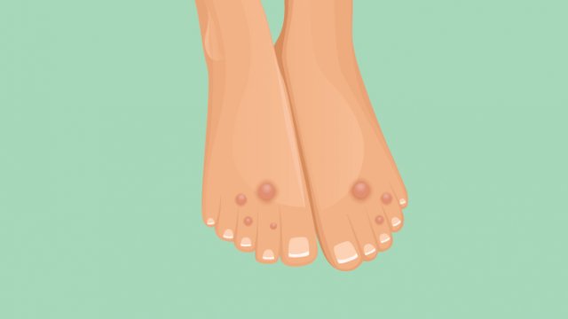 Ilustrasi (halodoc).