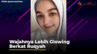 VIDEO: Viral, Wanita Ini Ngaku Wajahnya Lebih Glowing Berkat Ruqyah