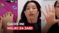 VIDEO: Gadis Cantik Ini Miliki 24 Jari