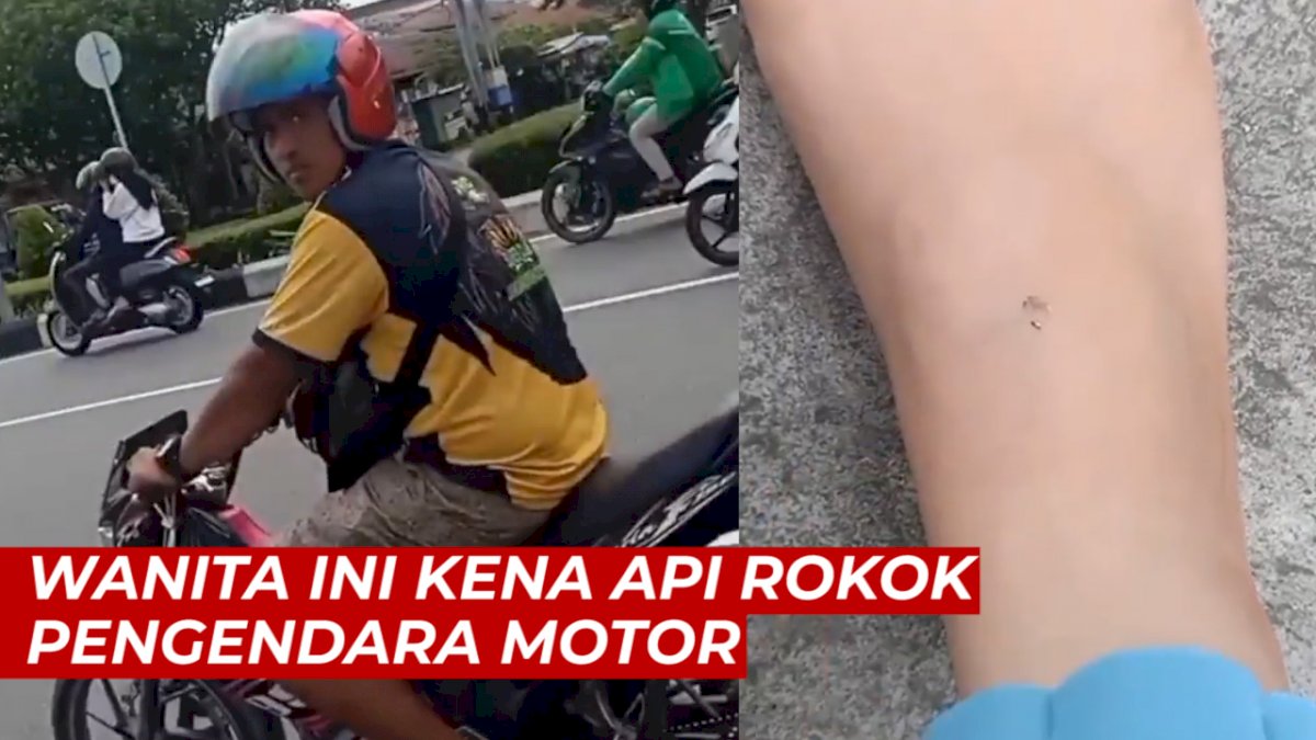 VIDEO: Wanita Ini Kena Api Rokok Pengendara Motor, Kakinya Sampai Memerah