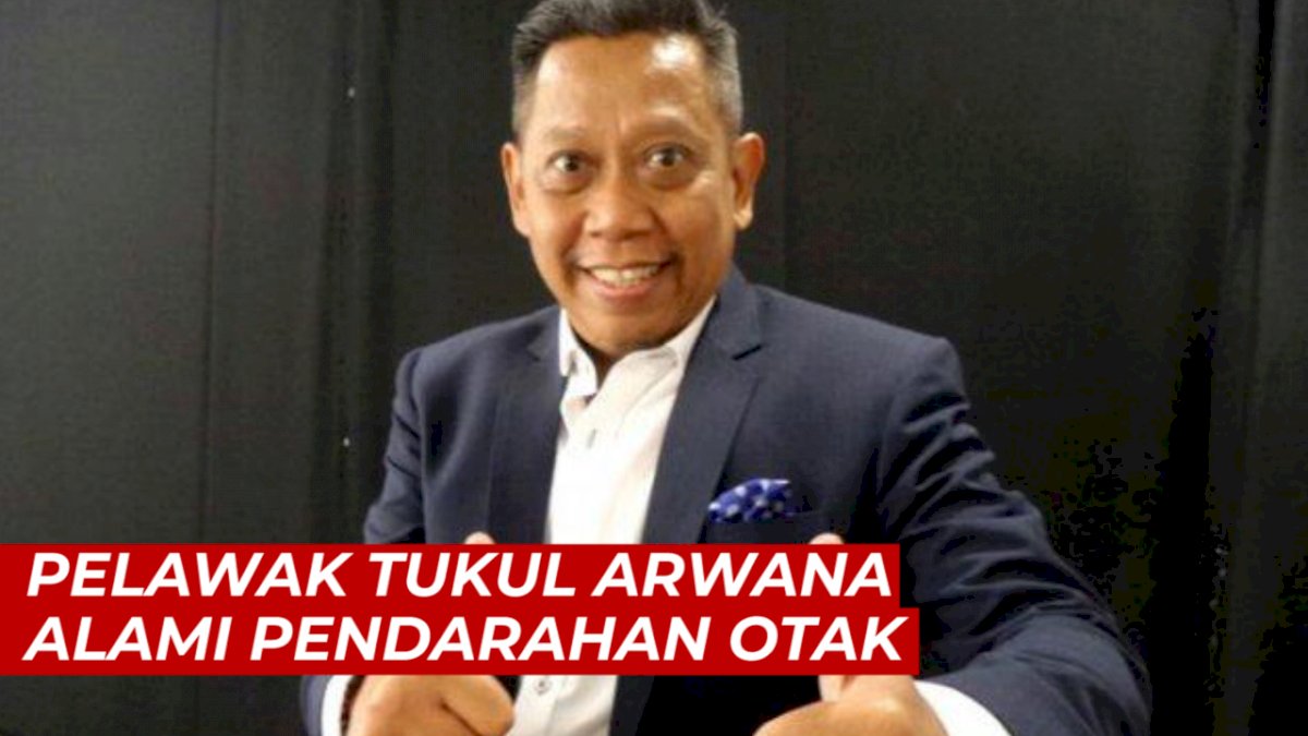 VIDEO: Pelawak Tukul Arwana Alami Pendarahan Otak