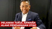 VIDEO: Pelawak Tukul Arwana Alami Pendarahan Otak