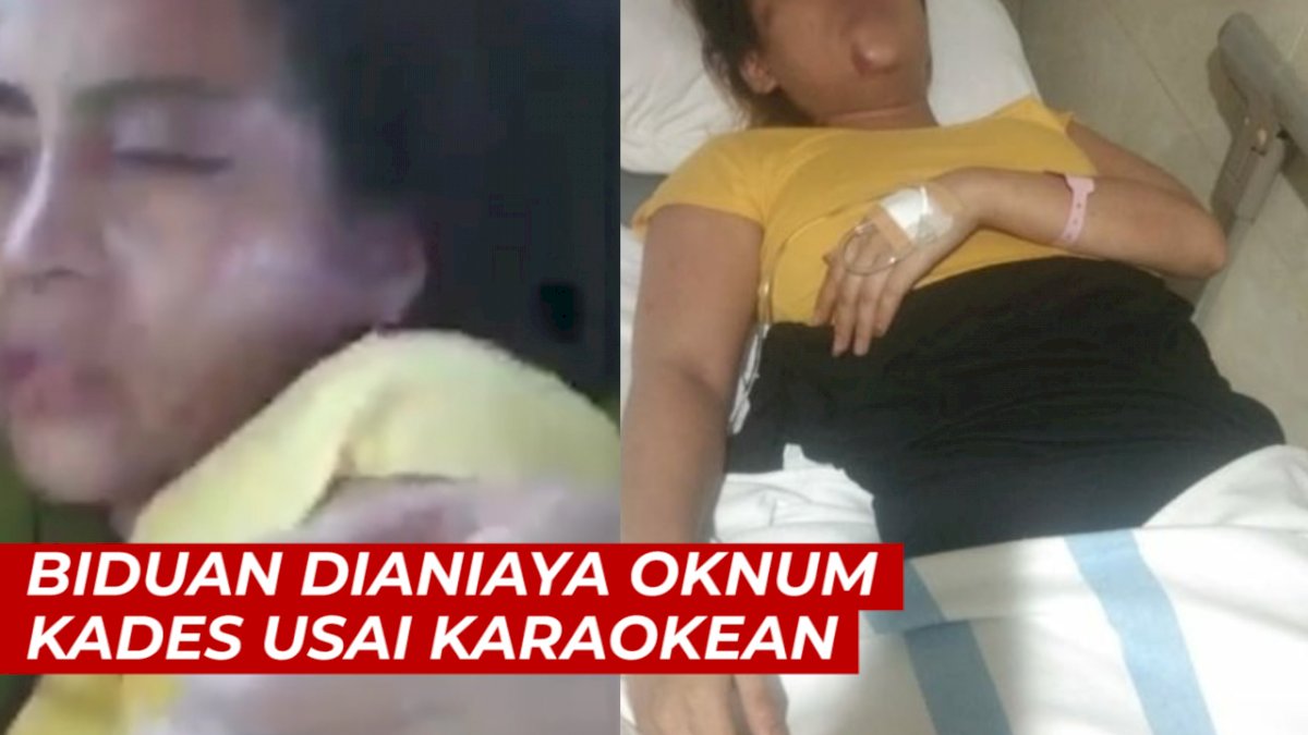 VIDEO: Viral, Biduan Dianiaya Oknum Kades Usai Karaokean