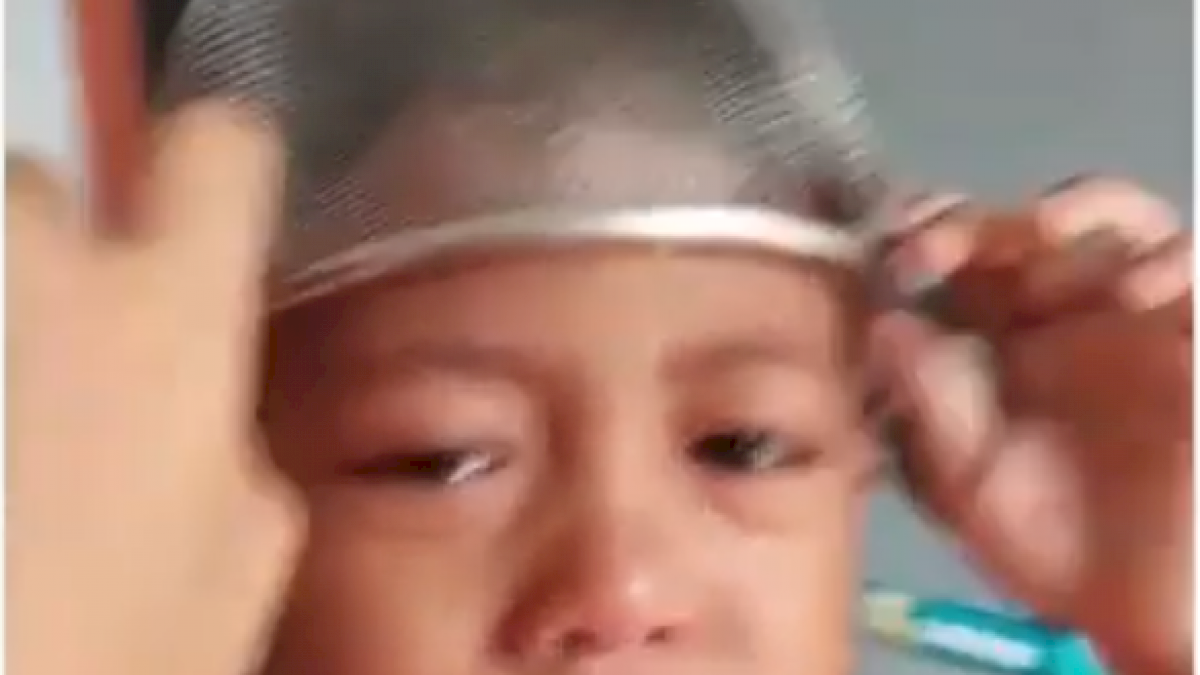 VIDEO: Bocah Ini Nangis Tersedu-sedu, Lantaran Saring Makanan Tersangkut di Kepala