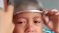 VIDEO: Bocah Ini Nangis Tersedu-sedu, Lantaran Saring Makanan Tersangkut di Kepala