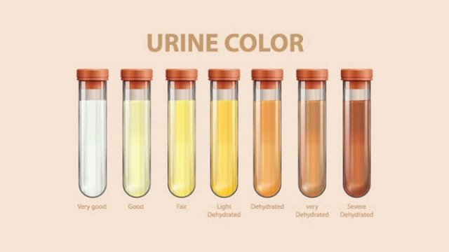 Kenali penyakit dalam tubuh lewat warna urine (halodoc)