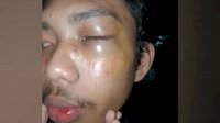 Kecam Aksi Represif Aparat Keamanan, Permikomnas Wilayah XI Tuntut Polisi Usut Dugaan Tindak Kekerasan