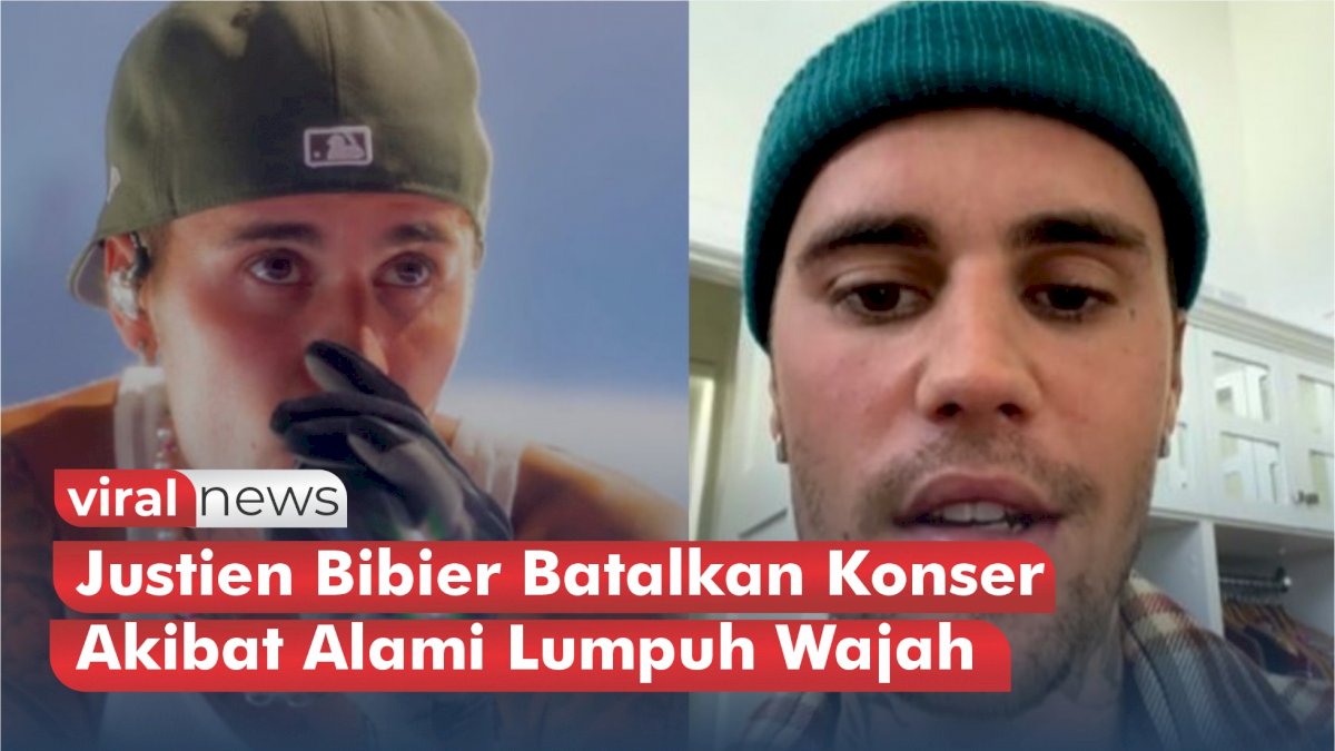 VIDEO: Justien Bibier Batalkan Konser Akibat Alami Lumpuh Wajah