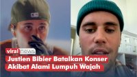 VIDEO: Justien Bibier Batalkan Konser Akibat Alami Lumpuh Wajah