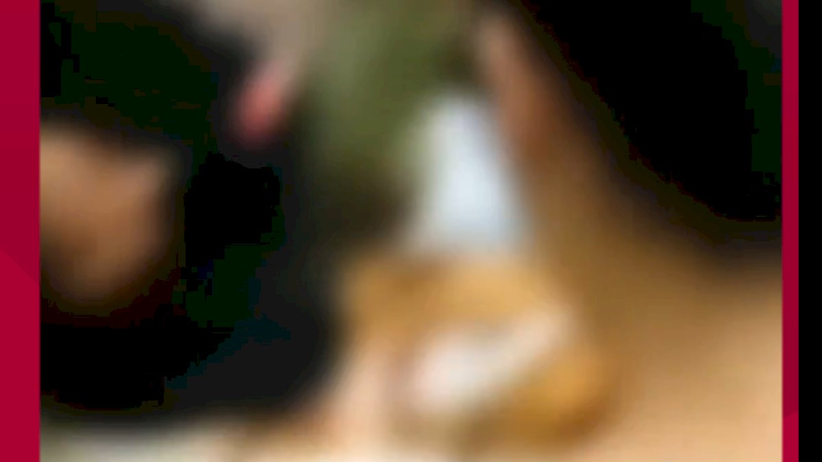 VIDEO:Bocah di Mamasa Meninggal Dunia Setelah Digigit Anjing