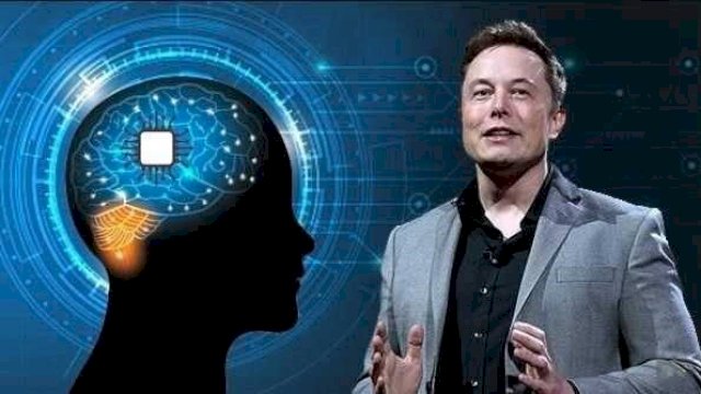 Perusahaan Elon Musk kembangkan chip penderita autisme. Foto: Internet