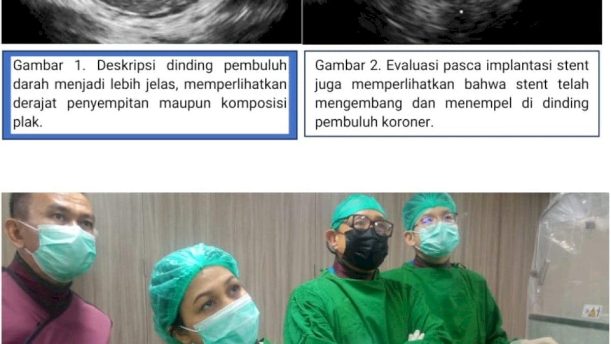OPINI: Meneropong Dinding Pembuluh Koroner dengan Pencitraan Intra Koroner